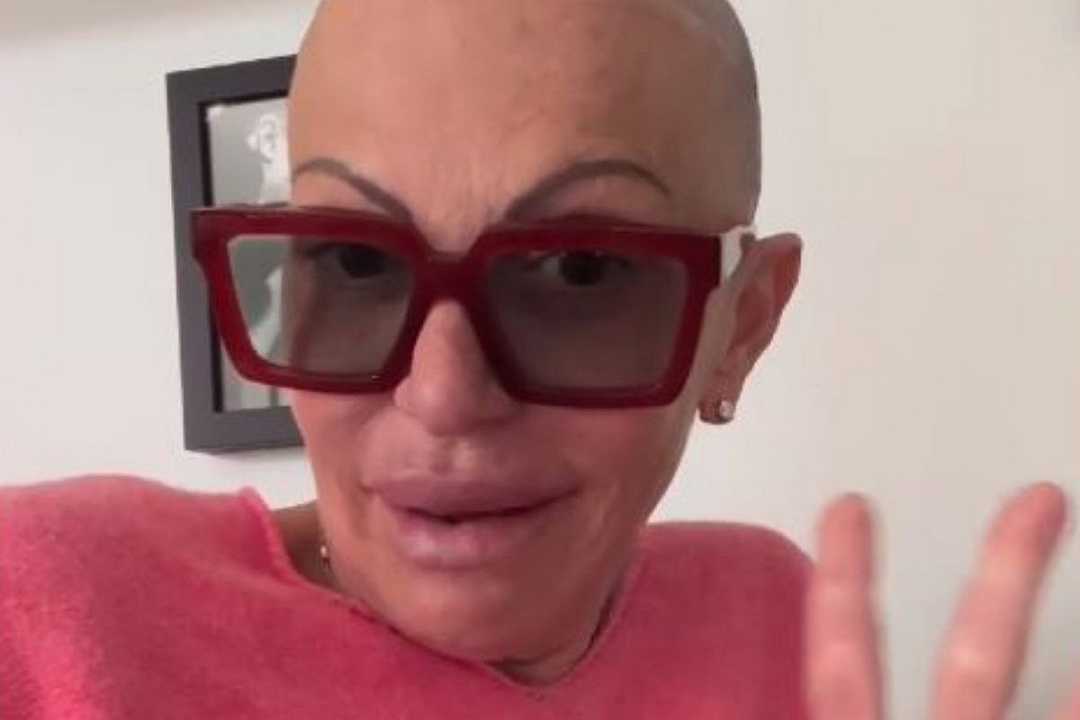 Masterchef: Elena racconta sui social la sua lotta all’alopecia