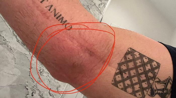 Stati Uniti, infortunio insolito per un giocatore di baseball: è stato colpito da una bottiglia di Champagne