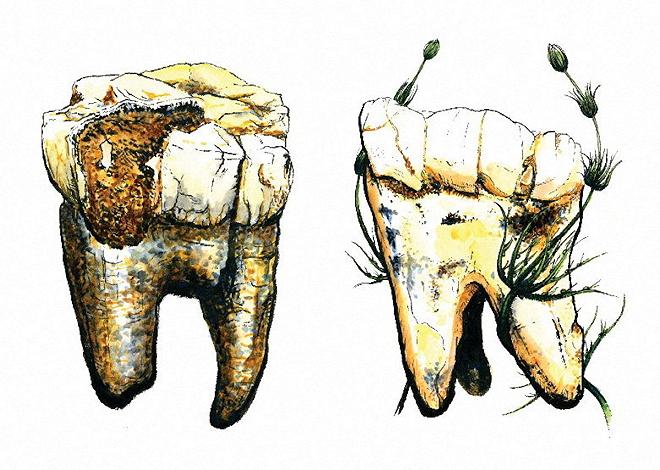 denti australopitechi