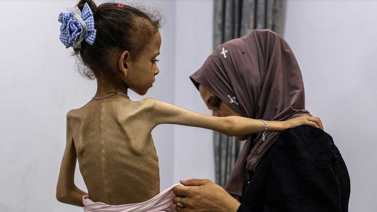 Come possiamo parlare di cibo quando l’intera popolazione di Gaza muore di fame